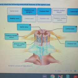 Correctly joint anatomical solved tibiofemoral transcribed