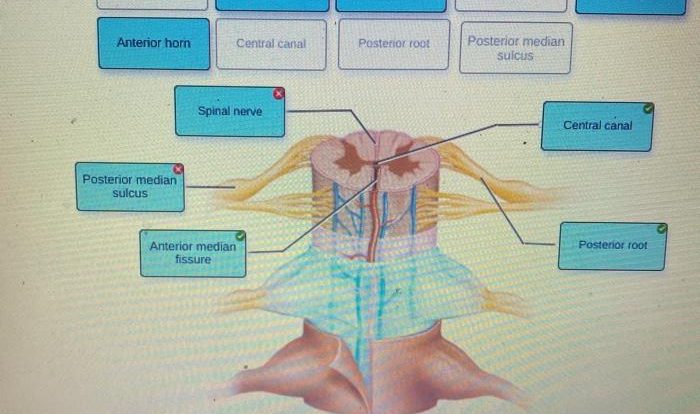 Correctly joint anatomical solved tibiofemoral transcribed