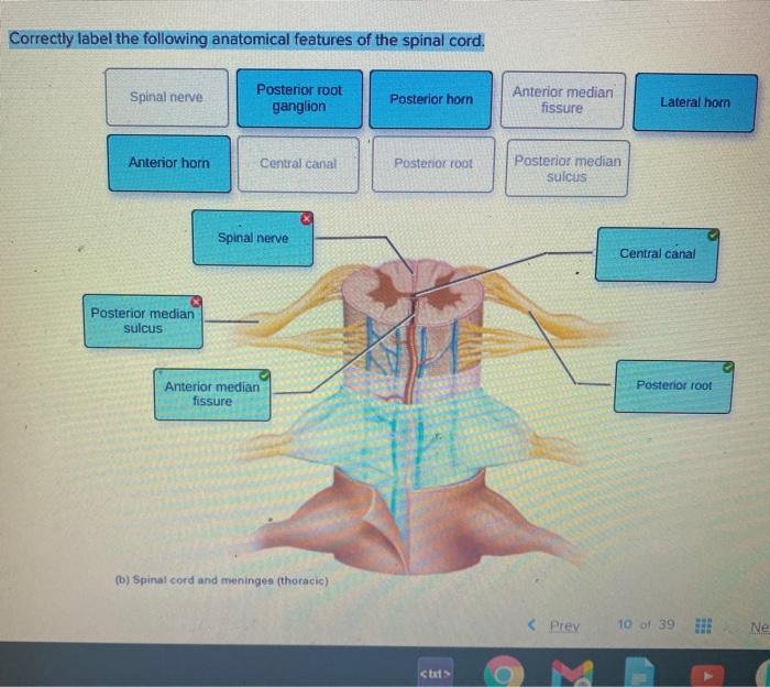 Correctly joint anatomical solved tibiofemoral transcribed