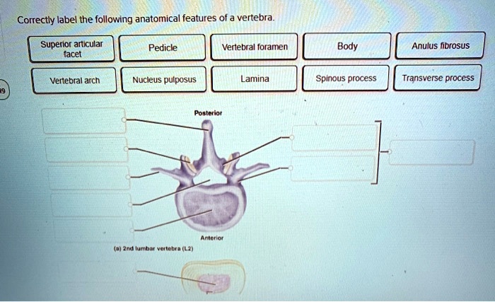 Correctly label the following anatomical features of the vertebra